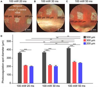 Large-Area Photoreceptor Degeneration Model in Rabbits by Photocoagulation and Oxidative Stress in the Retina